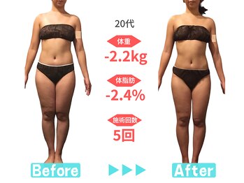 ビースタイル 春日井店(B'style)/20代マイナス2キロ