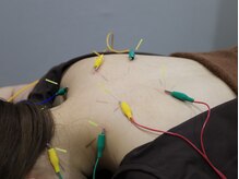 リベルタ鍼灸整骨院 新宿院(Liberta鍼灸整骨院)/深層筋にもアプローチ