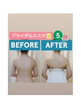 ティアエ(T-ae)/【ブライダルエステ】