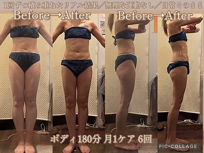 ボディリカバリー(Bodyリカバリー)の写真