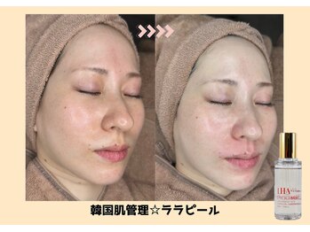 バベルトータルビューティー 北堀江店(Babel Total Beauty)/第4世代【ララピール】