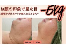 熟練された技術でボディメイク☆