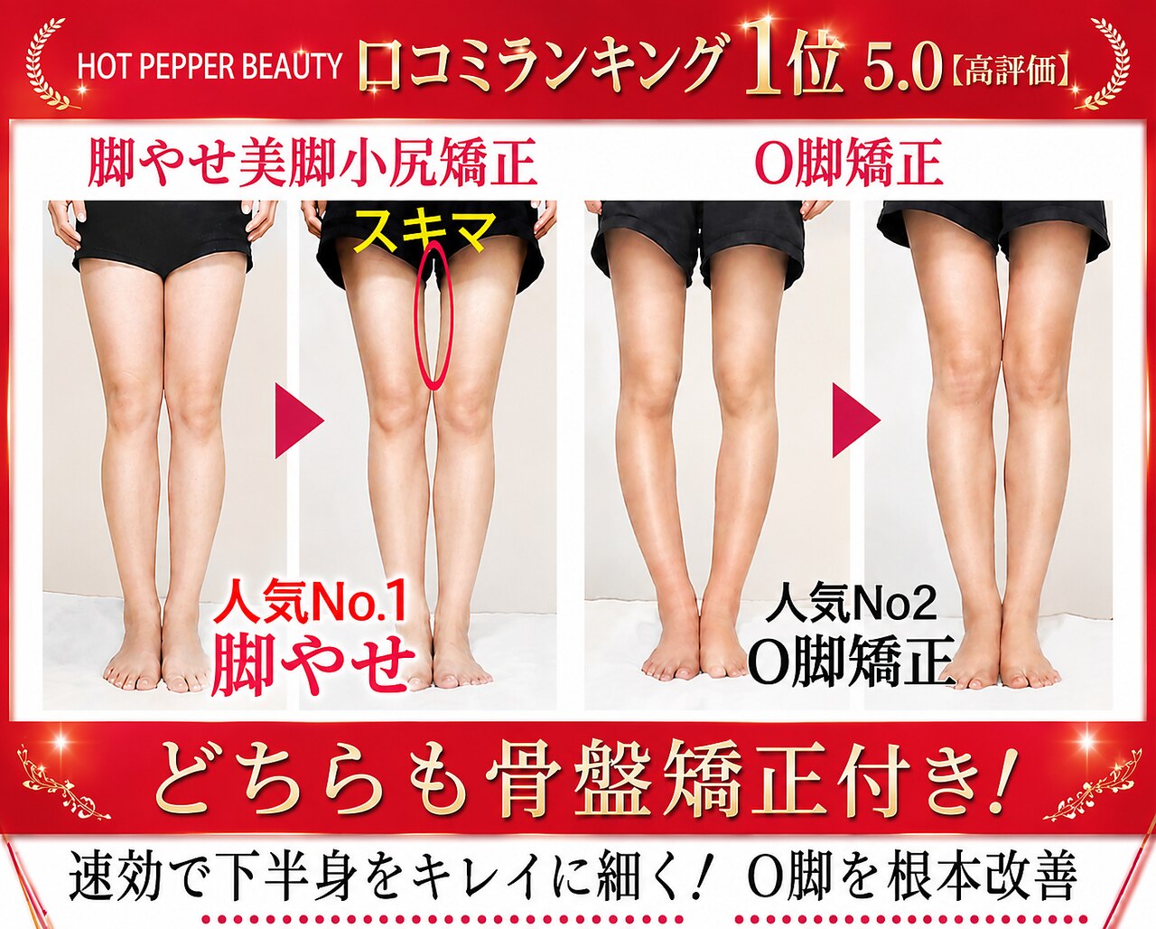 O脚・X脚を改善したい！京都で人気のアロマトリートメント