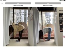 ナオル整体 大森店(NAORU整体)/20代女性、継続施術3ヶ月経過