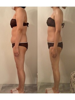 ピカケ(PIKAKE)/筋膜リリース