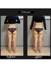 エヌボーテ(N. beaute)/下半身コース二回目