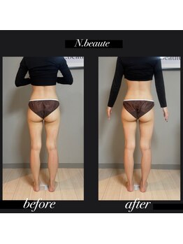 エヌボーテ(N. beaute)/下半身コース二回目