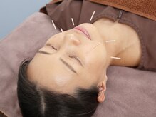 ジネコラボ 茅ヶ崎(Gyneco-labo)/お顔のむくみ対策にも