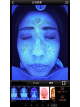 メンズミーシェ(Men's Meshie)/AI肌診断機