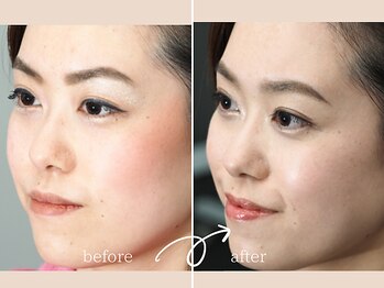 レディゴー(LADY GO)/アムロちゃん世代メイク