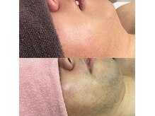 アミオ(amio)の雰囲気（ルミクス脱毛で日々のストレスが無くなります）