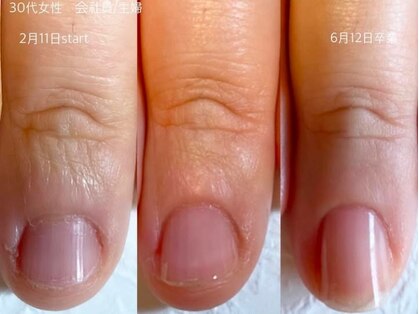 レア(Le'a)の写真