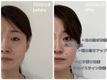 KTYフェイスジム 名古屋栄店(KTY FACE GYM)/3ヶ月での変化