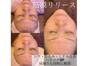 プルメリア(Plumer’a)