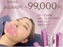 ビテュセ(美Tu sais)の雰囲気（ローマピンク♪黒ずみケア、クスミケア唇のお悩み◎）