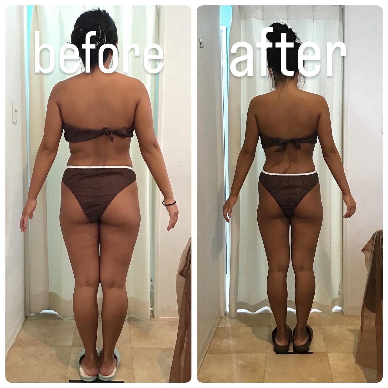 ラジオ波 キャビテーションに関するサロン Beauty salon Lino Pono