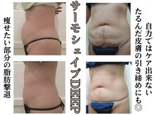 スパイア(SPIRE)の雰囲気（サーモシェイプDEEPで脂肪撃退・たるみケアにも◎痩身/小顔）