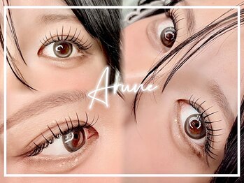 アルネ 大宮店(Arune)