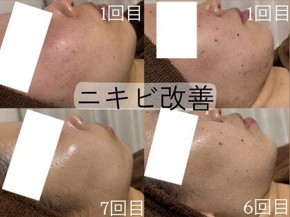 ベル みどりの店(belle)の写真