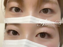 アフェクション アイビューティー(Affection eye beauty)/まつげエクステ