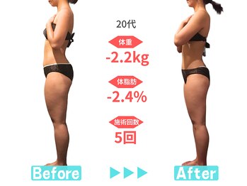 ビースタイル 春日井店(B'style)/20代マイナス2キロ