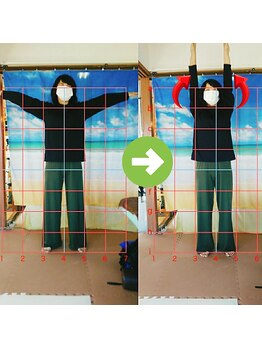 サプライズ整体院/40代ママさんの肩こり初回結果