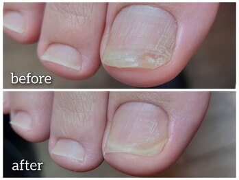 「爪が伸びないんです・・・」