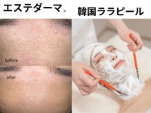 プラスボーテ 幡ヶ谷(plus beaute)/ララピール×エステダーマ