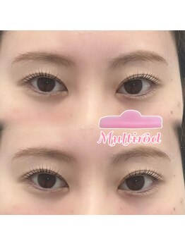 ベルム 市川店(BELME)/デザインパーマ☆