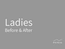 アイライクミー センター南店(EYE like me)/Ladies Before & After