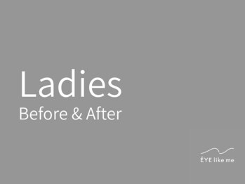 アイライクミー センター南店(EYE like me)/Ladies Before & After