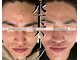 ヴェアリー 広尾(VARY)の写真/【自信肌を創る】もう治らないと諦めかけていた悩んでいたニキビ、ニキビ赤み残り、毛穴、全部綺麗に！