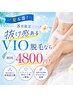 ◆【夏本番!】8月限定 抜け感あるVIO脱毛ならバニスティへ♪ 初回4800円!◆