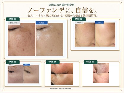 ジェムスキンラボ 所沢店(GEM SKIN LAB)の写真