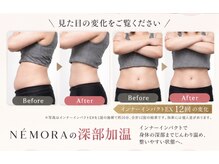 ネモラ(NE´MORA)の雰囲気（温め×フェムケア矯正で身体を土台から整える）