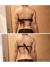 アクアリジェ/痩身リンパ1回の変化