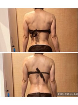 アクアリジェ/痩身リンパ1回の変化