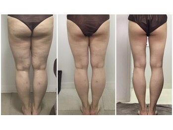 ビューティーワークスシャンティ 柏店(Beauty Works Shanti)/お客様の成果☆