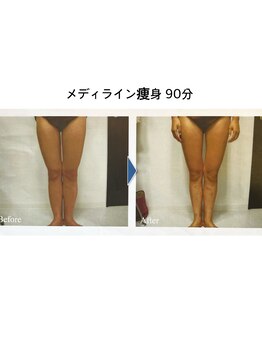 介正鍼灸整骨院つきぐま/