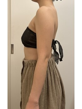 リバース(Rebirth)/脂肪燃焼剤導10ml導入ビフォー