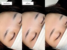 エムドット(m.)/アイブロウワックス脱毛