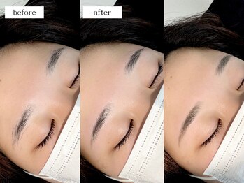 エムドット(m.)/アイブロウワックス脱毛