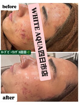 ホワイトアクア 四日市店(WHITE AQUA)/メンズエステ四日市