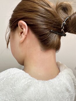 アンドアール(&R.)の写真/《大人気★速攻でツルツルお肌になれるシュガーリング脱毛》光脱毛と併用のダブル脱毛でツルツル長持ち！