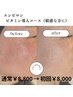 【エンビロン】クールビタミン導入コース　50分通常8800円（敏感な方）岐阜