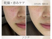 スリースリー(THREE THREE)/乾燥・赤みケア