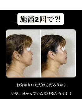 真美(Sinbi)/施術2回で!!