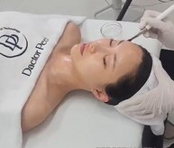 ブロッサム(Blossom)