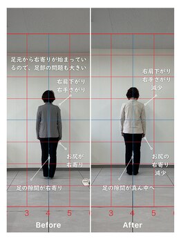 ハル 箕面(HALU)/4回目before&after姿勢改善