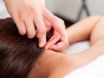 鍼灸ヨスガ(鍼灸Yosga)/頭痛